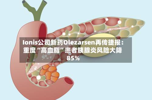 Ionis公司新药Olezarsen再传捷报：重度“高血脂”患者胰腺炎风险大降85%